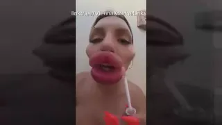 Vienna Xtreme plays with her swollen Bimbo Lips