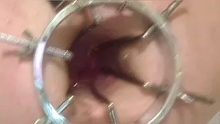 Enema. Anal douche. Close-up view from the inside. Full anus of water. Dildo in the anus. Large anal speculum.
