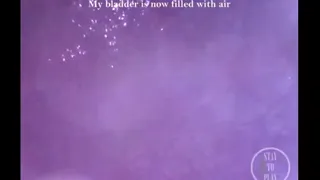 When having a full bladder just isn't enough.